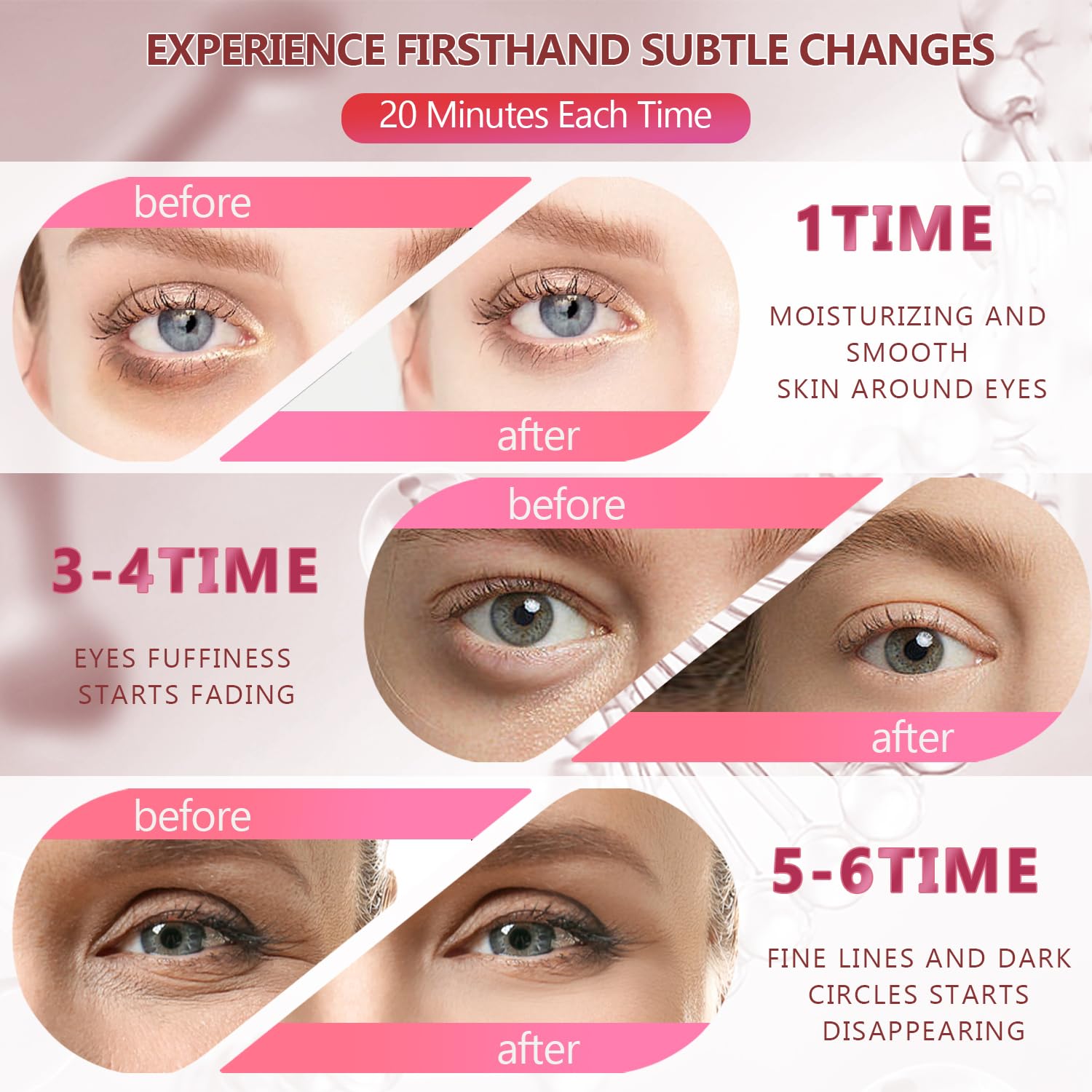 Pink Undereye Mask (60 Pcs), Collagen Hydrating Gel Pads, Reduce Puffiness, 30 Pairs Under Eye Patches for Dark Circles Puffy Eyes Treatment, Wrinkle, Women Men Beauty Personal Skin Care Products