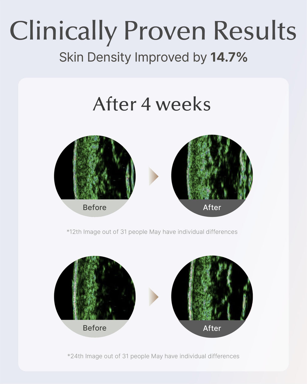SOORYEHAN Lifting Ampoule Serum (2.02fl oz) - Triple-Action Anti-Aging Serum for Skin Tone, Texture, and Elasticity with 5% Niacinamide and Triple Collagen Blend