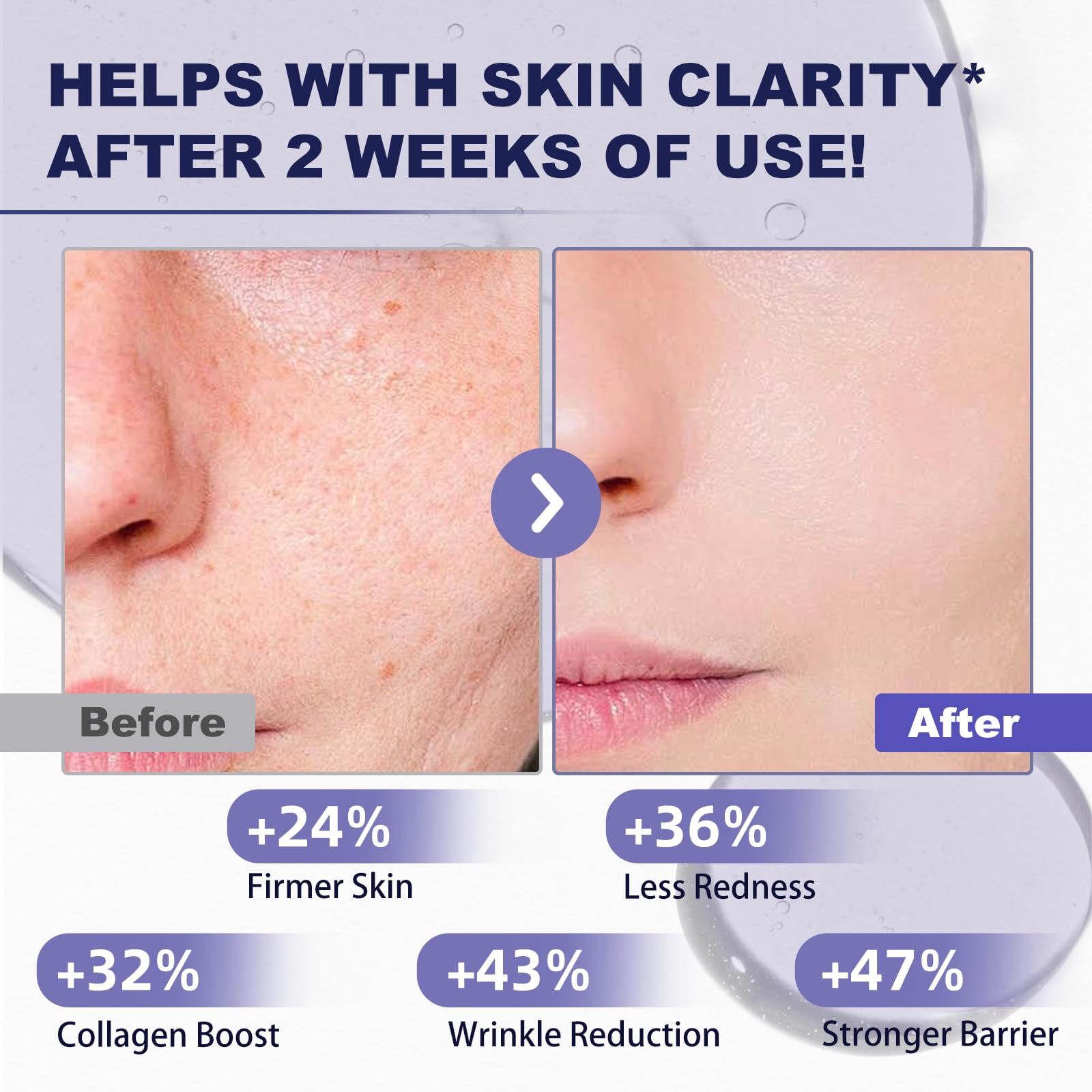 Bakuchiol Retinol Alternative Serum - 40,000 ppm All Plant-Based Formula Anti-Aging Face & Eye Care Plumping Serum for Sensitive Skin - Natural Firming & Elasticity