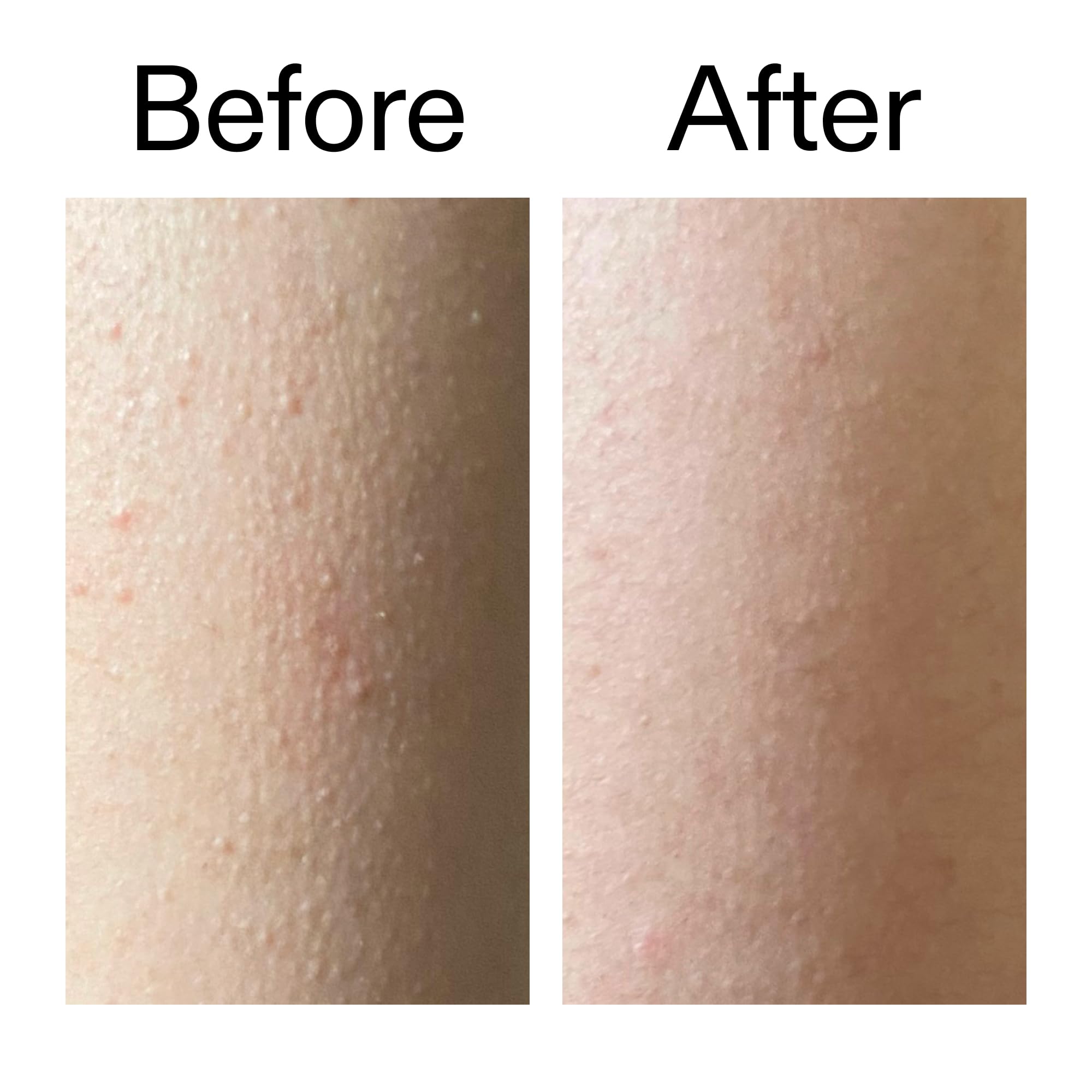The INKEY List Glycolic Acid Exfoliating Body Stick 45g, Multiple Concerns, One Targeted Solution, Delivers Deep, Effective Exfoliation, Fragrance Free, Suitable For All Skin Types