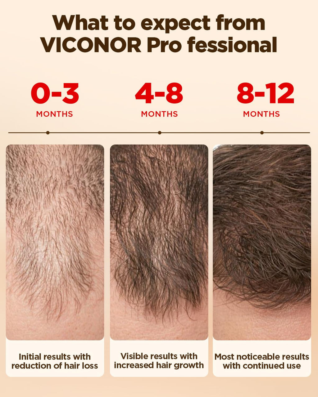 Hair Growth System: Red Light Therapy for Hair Growth Laser Cap - FDA Cleared Laser Therapy Device; Low Level Laser Therapy (LLLT) Device for Home Use, Hands-Free Portable Design