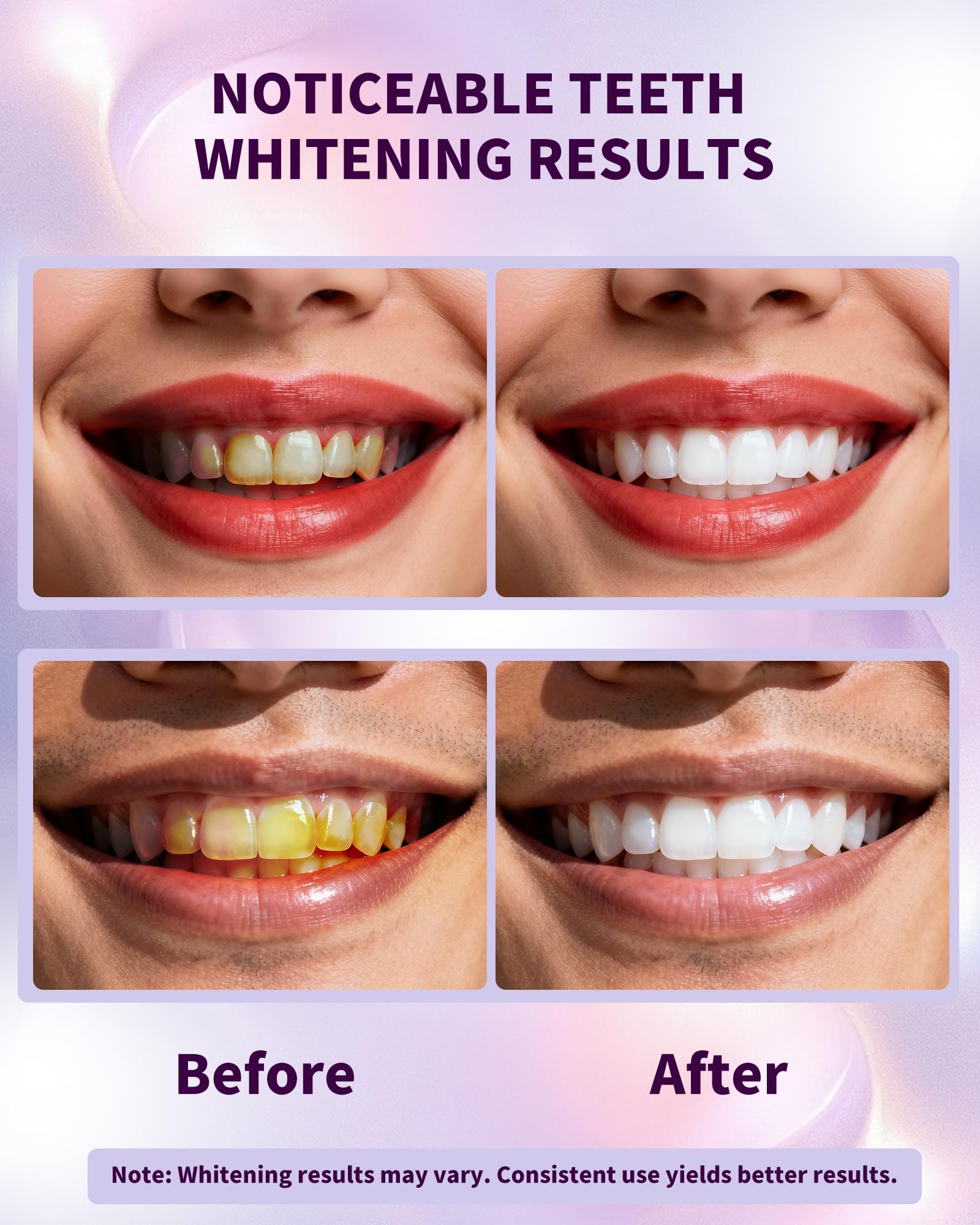 Ktintar Purple Whitening Strips, Color Correcting Purple Teeth Whitening Strips for Sensitive Teeth, Removes Yellow Stains, Enamel Safe, 30 Min Treatment, 14 Treatments, 28 Strips