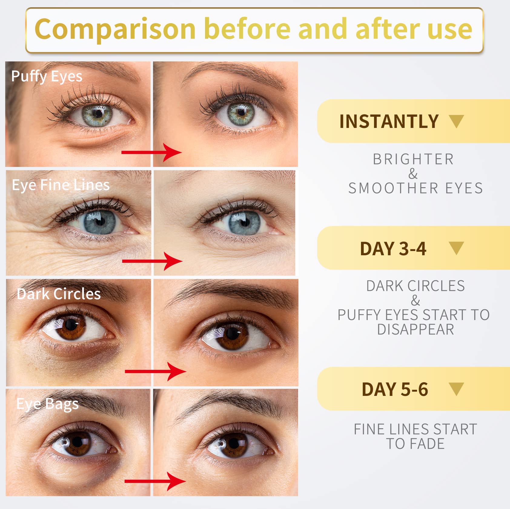 NAZANO 24K Gold Under Eye Patches - 60 Pack for Puffy Eyes, Dark Circles, Bags & Wrinkles with Collagen & Hyaluronic Acid - Eye Care Pads for Daily Skincare (Gold)