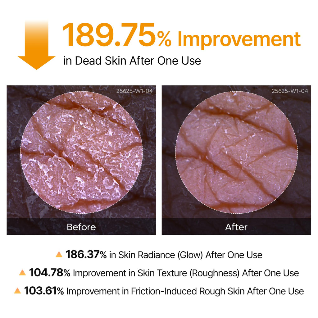 Dr.Melaxin Body Keratin Care Kojic Acid Turmeric Spray with AHA & PHA, Gentle Body Brightening & Exfoliating Peeling Solution for Dead Skin Cells & Texture, Korean Skincare, 6.76 fl.oz