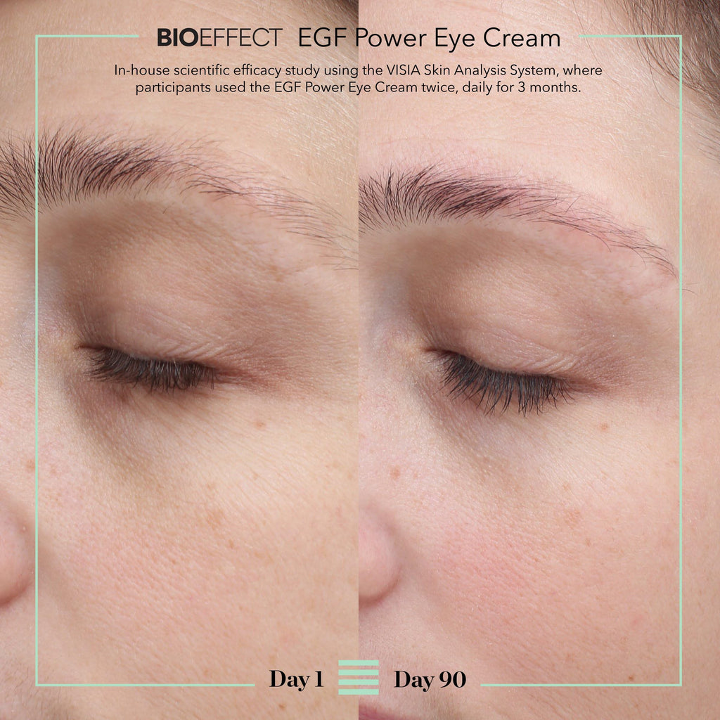 BIOEFFECT EGF Power Eye Cream Intensive Age-Defying Treatment 15 mL/0.51 oz