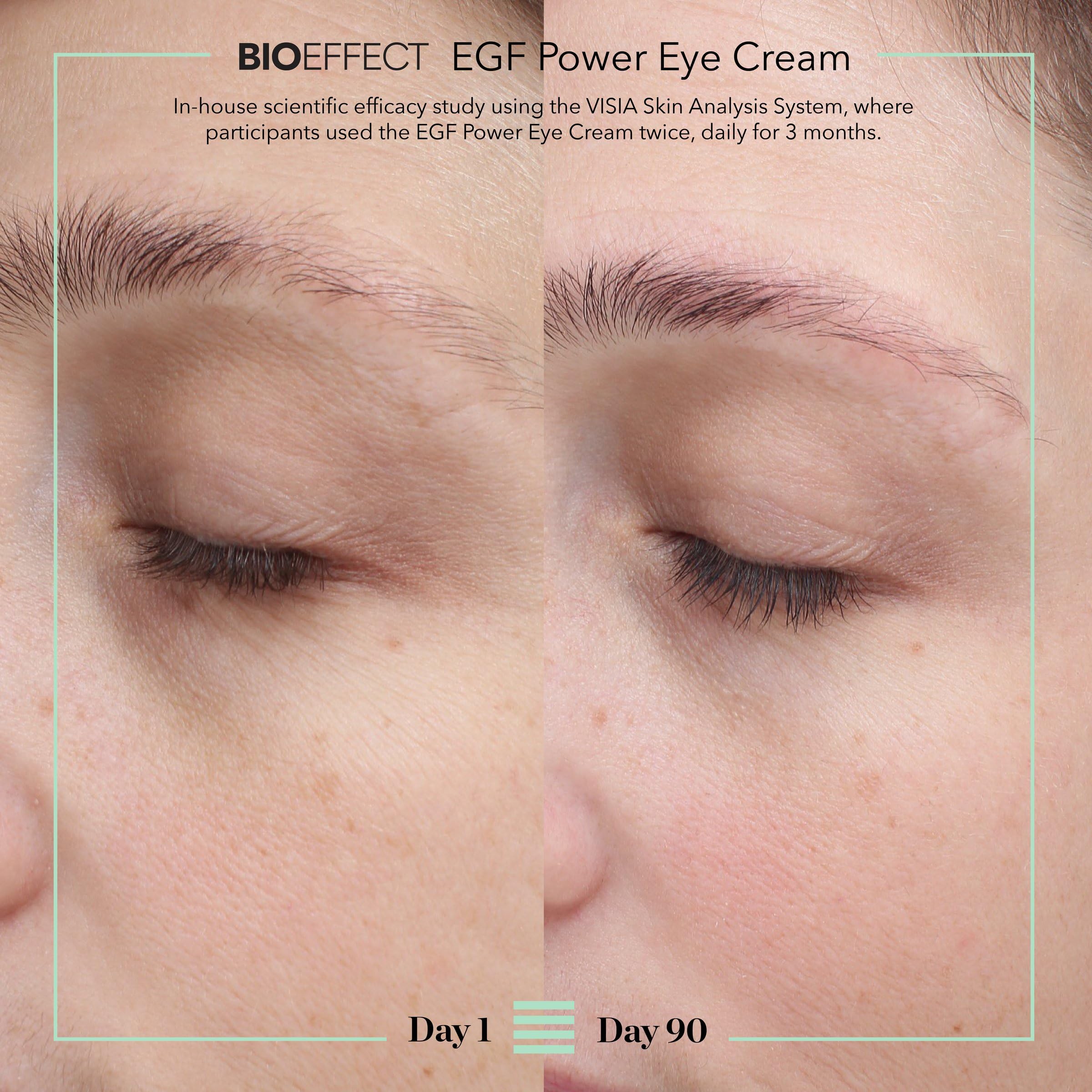 BIOEFFECT EGF Power Eye Cream Intensive Age-Defying Treatment 15 mL/0.51 oz
