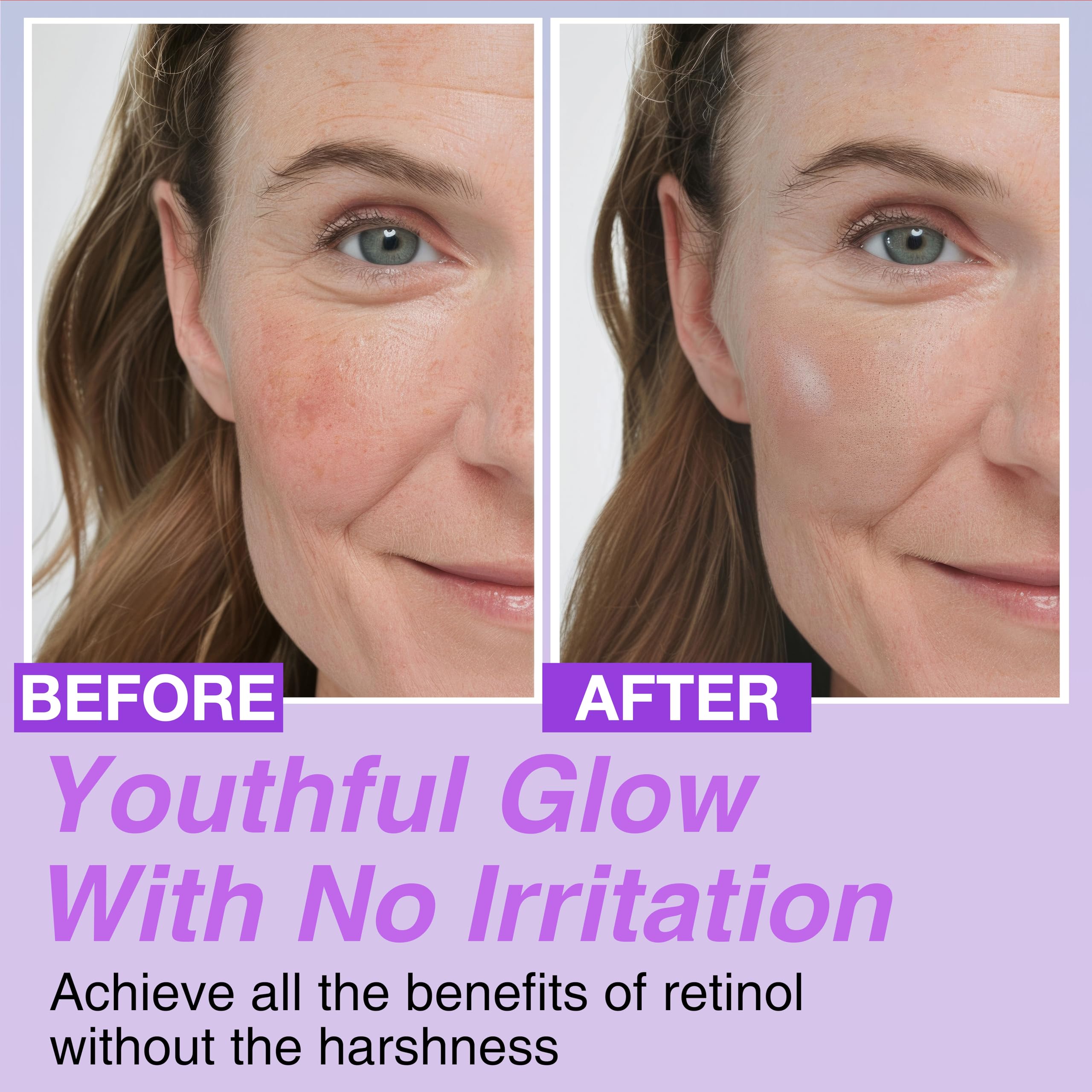 Korean Bakuchiol Concentrate Mix-in Serum 30,000 ppm - High Potency Retinol Alternative | Wrinkle Reduction Skin Firming & Smoothing - Anti-Aging Sensitive Skin Vegan & Cruelty-Free Non-GMO 2 oz