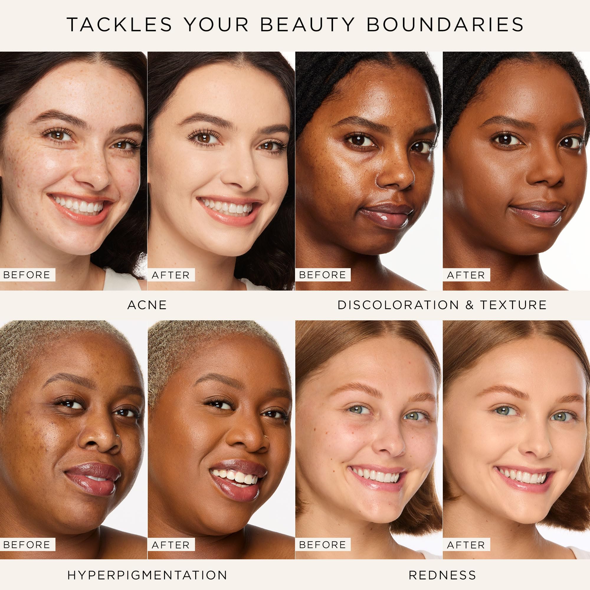 tarte shape tape concealer – Full Size-Coverage, Matte Finish for Under Eye, Dark Circles, Fine Lines, Redness & Discoloration, Longwear, Dermatologist-Tested, Vegan, Cruelty-Free