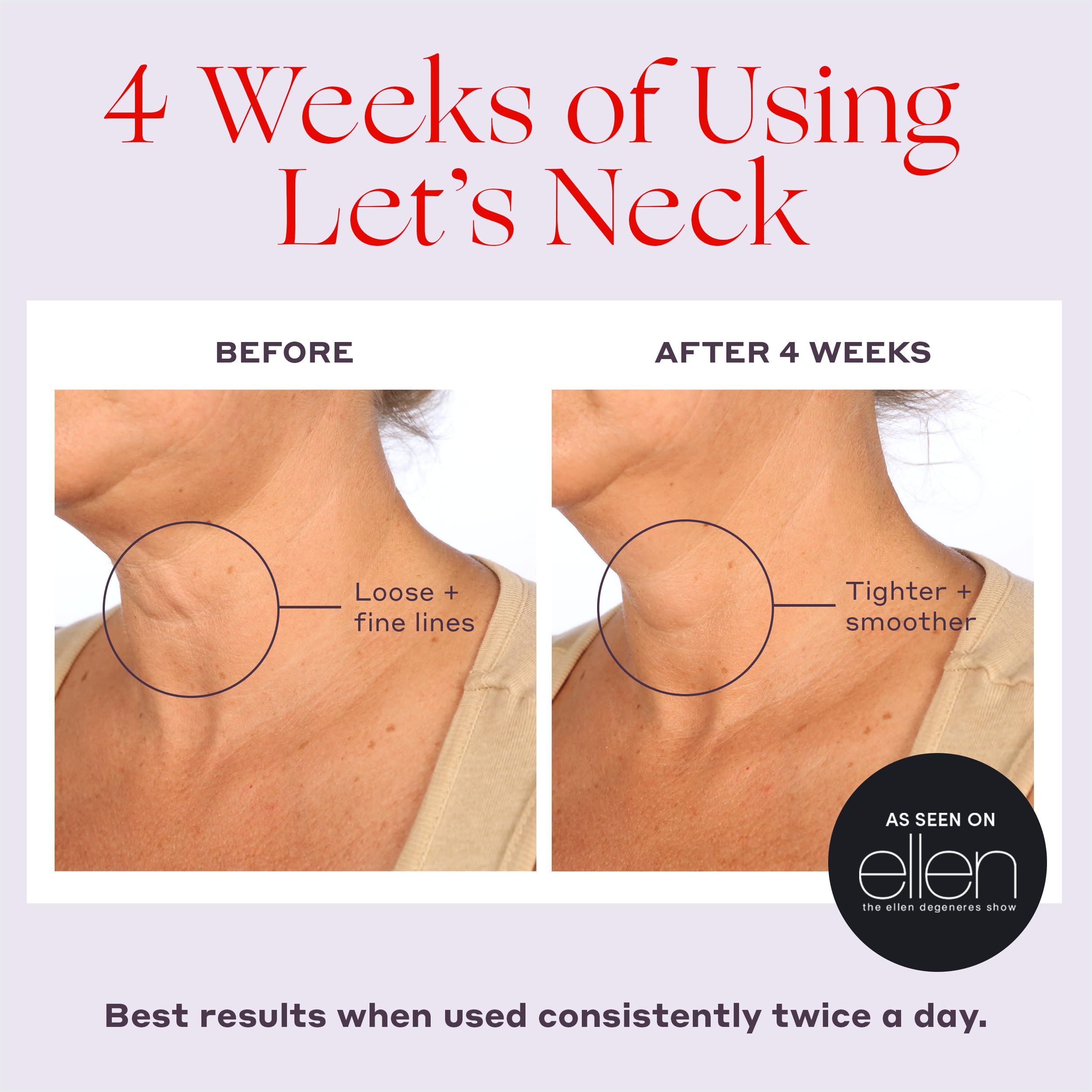Womaness Let's Neck Serum for Neck Tightening and Lifting, 50ml
