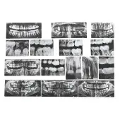 Dental X Rays Set of 15 with Chart by Roylco